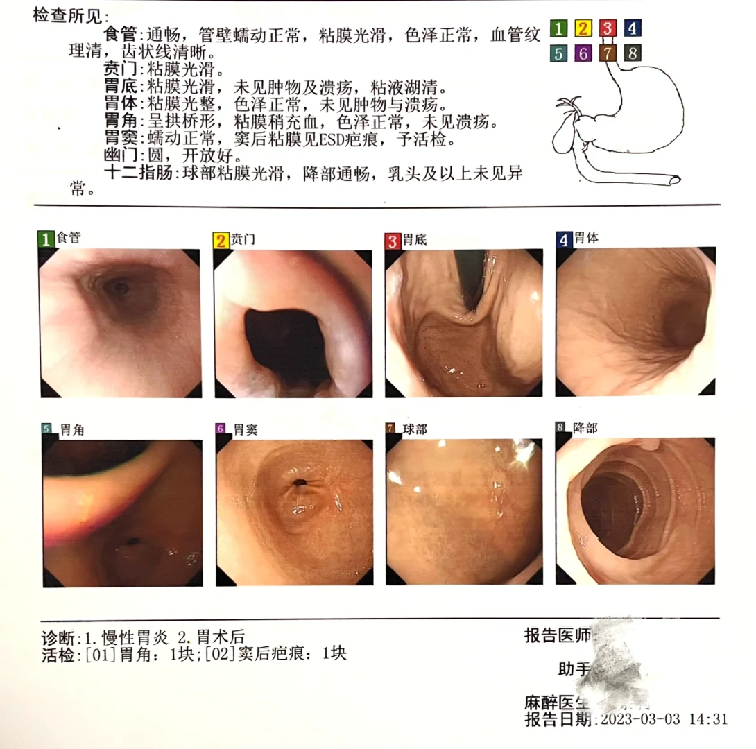 胃糜烂症状有什么