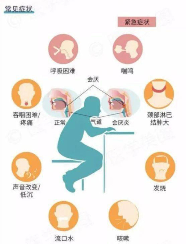 会厌炎是什么症状