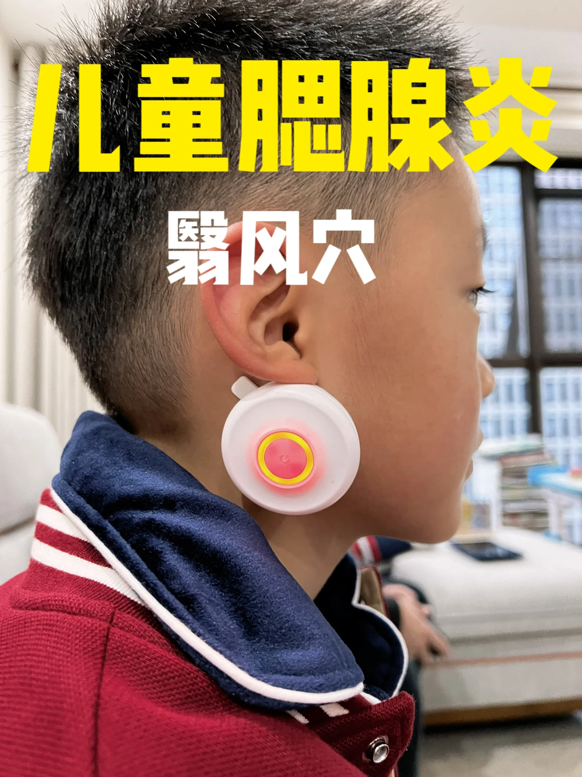 儿童腮腺炎