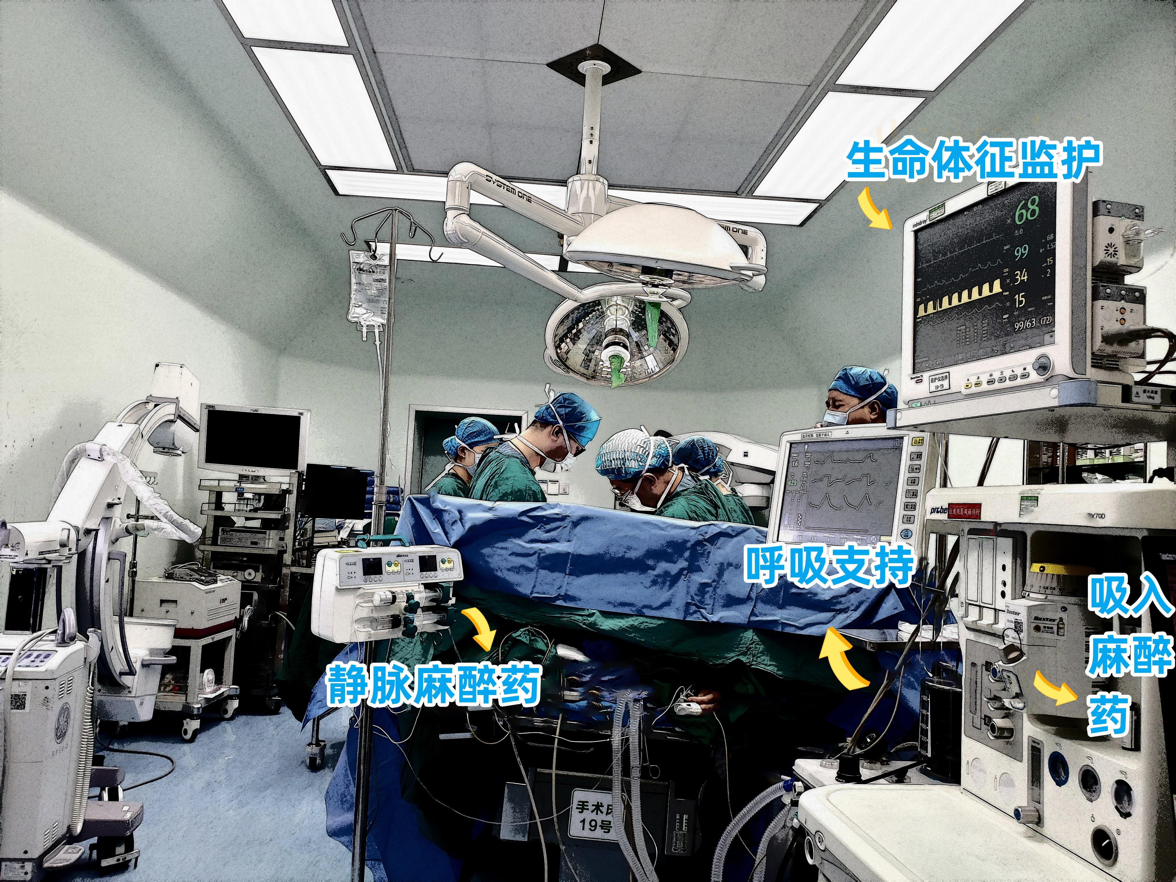 手术麻醉方式