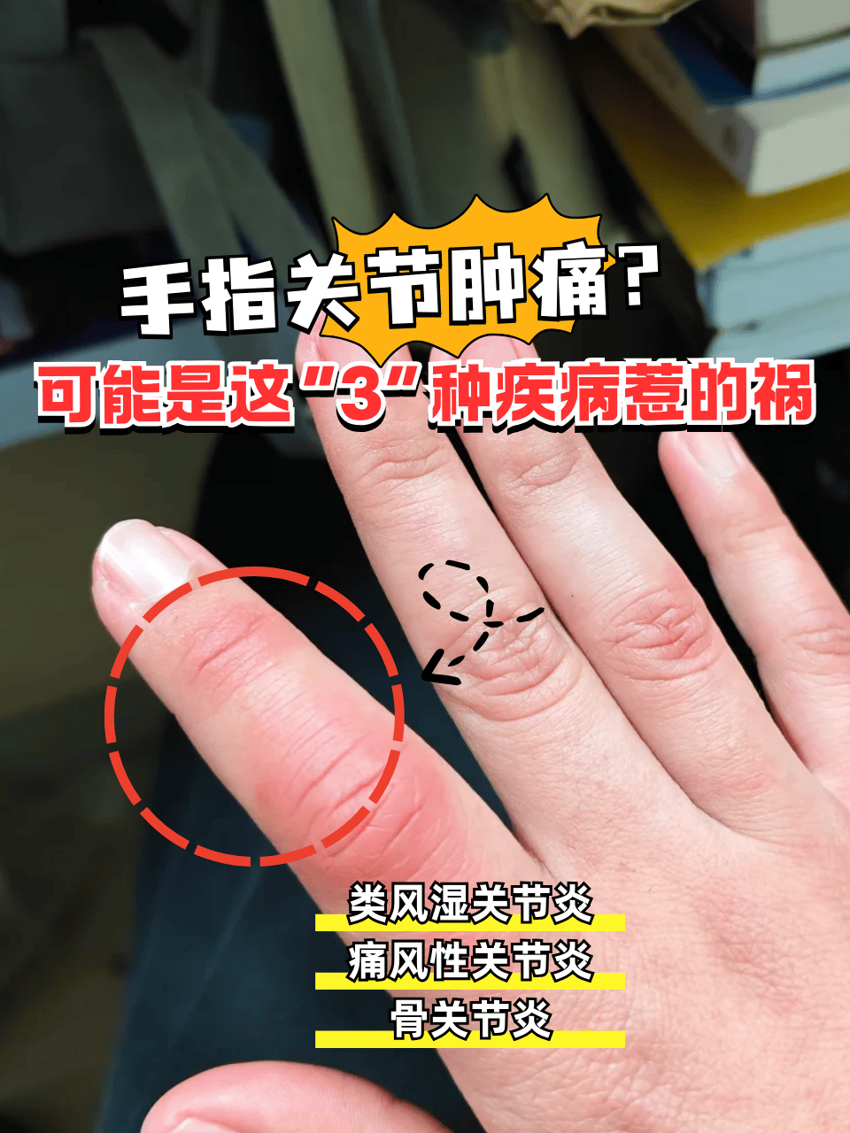 手指肚疼,怎么回事?