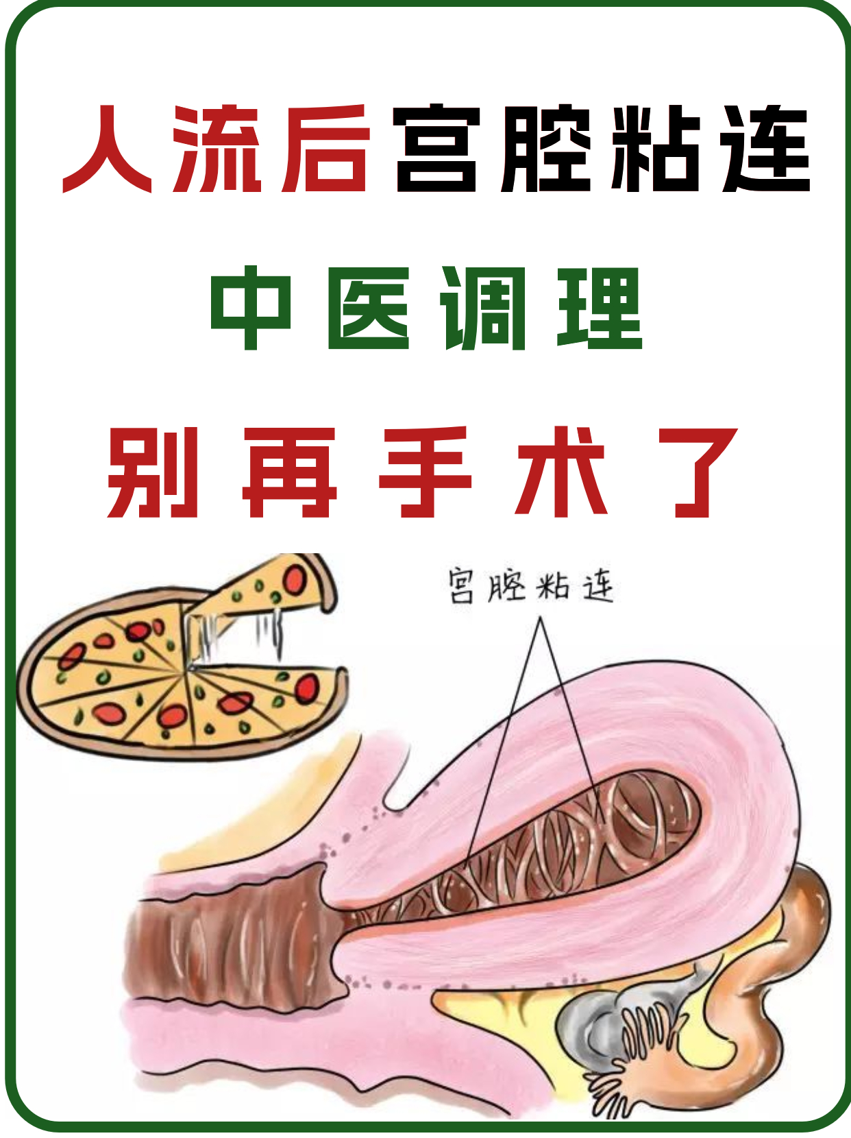 宫腔黏连是怎么检查出来的?