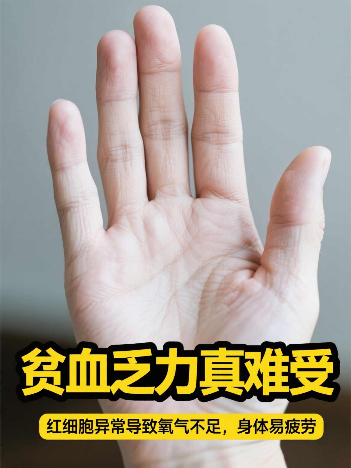 地中海贫血能治好吗