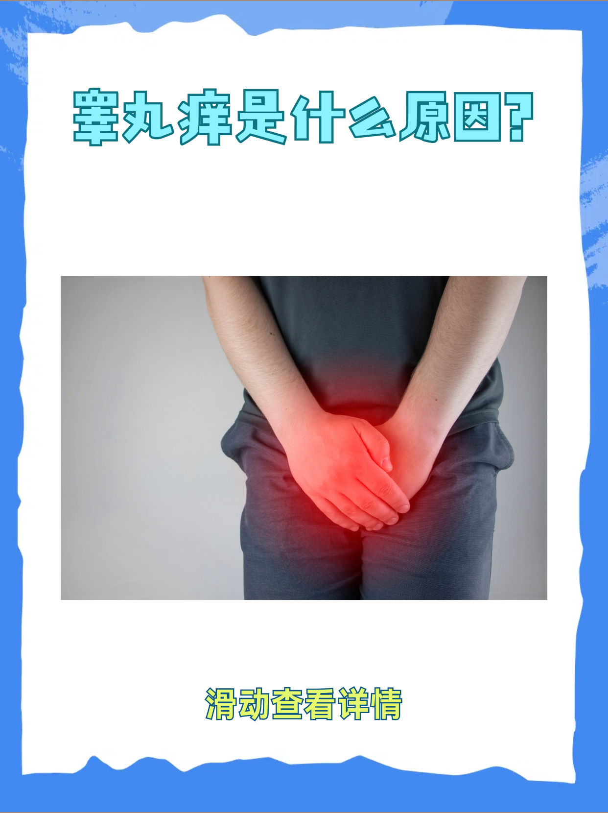 睾丸两侧很痒是怎么回事?