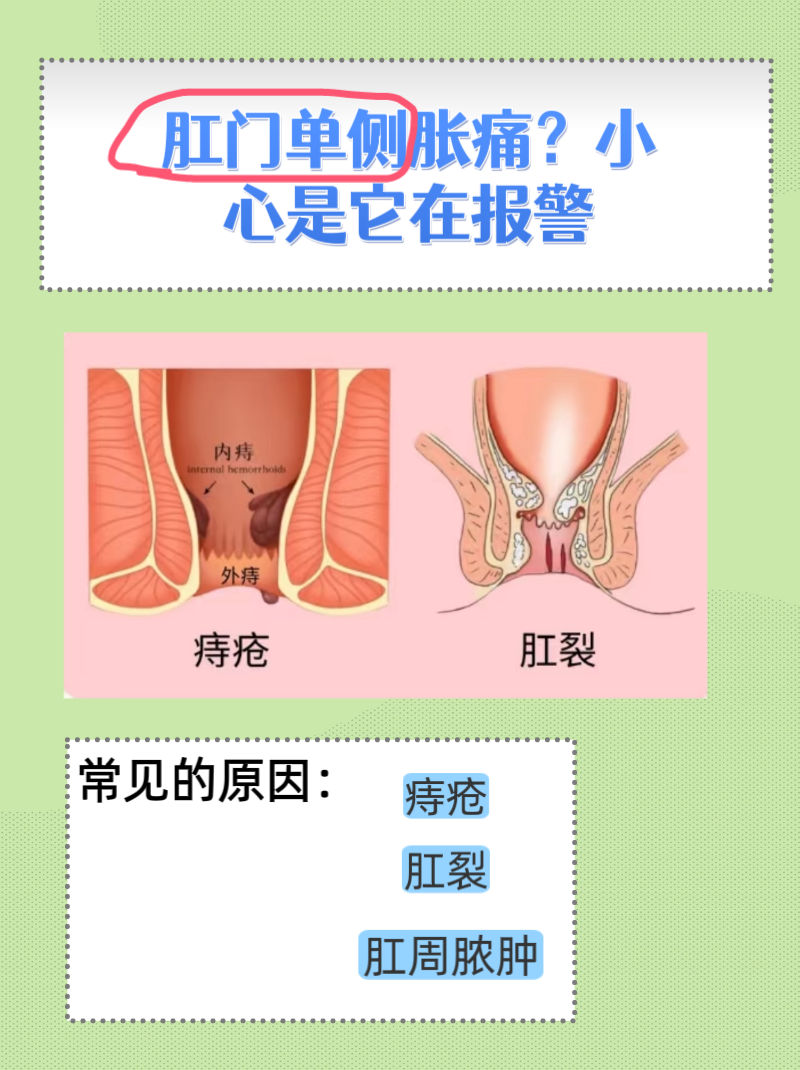 肛门胀痛怎么回事