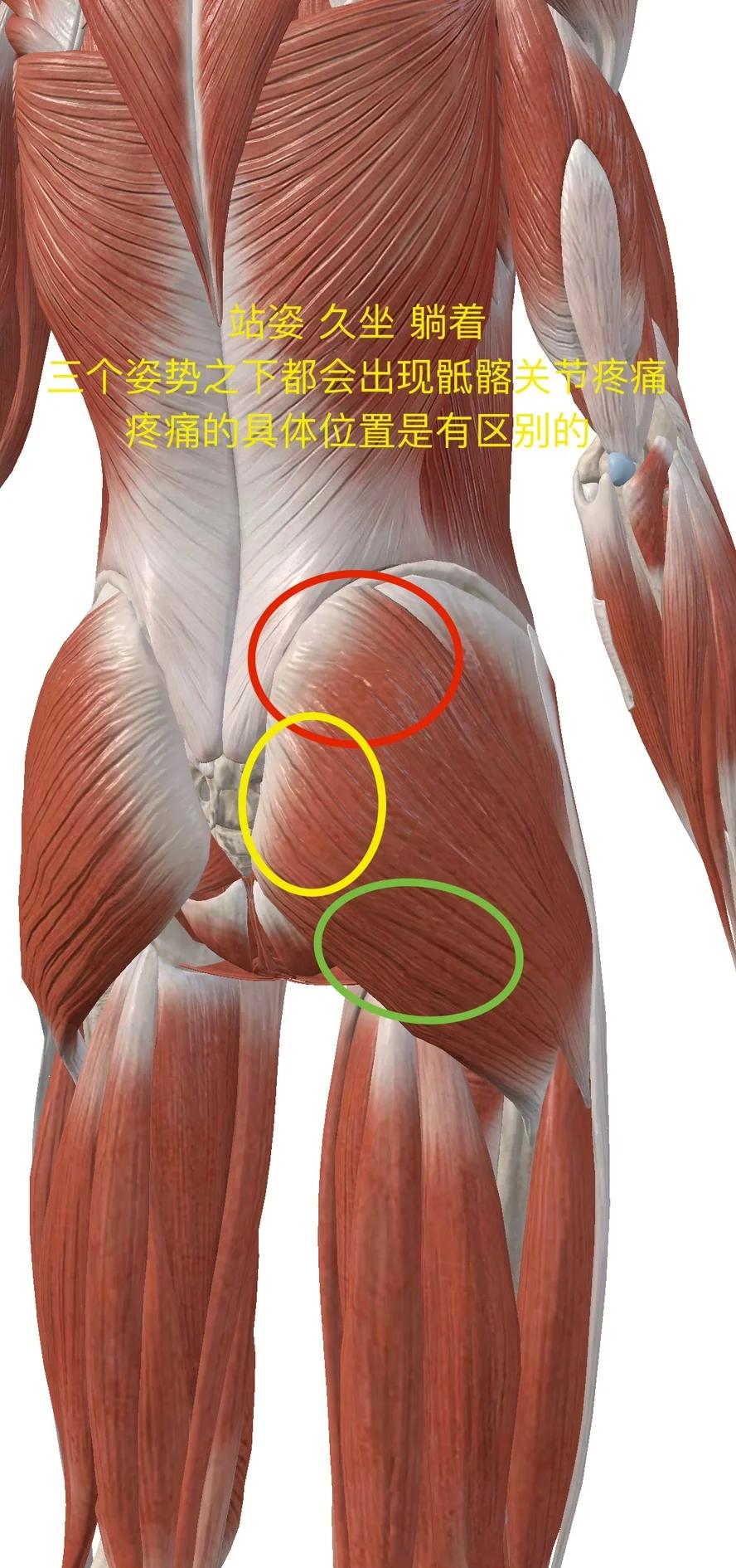 骶髂关节炎会瘫痪吗