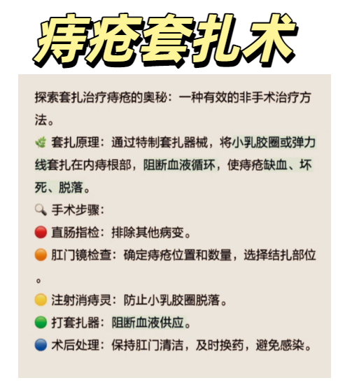 痔疮手术要多久?