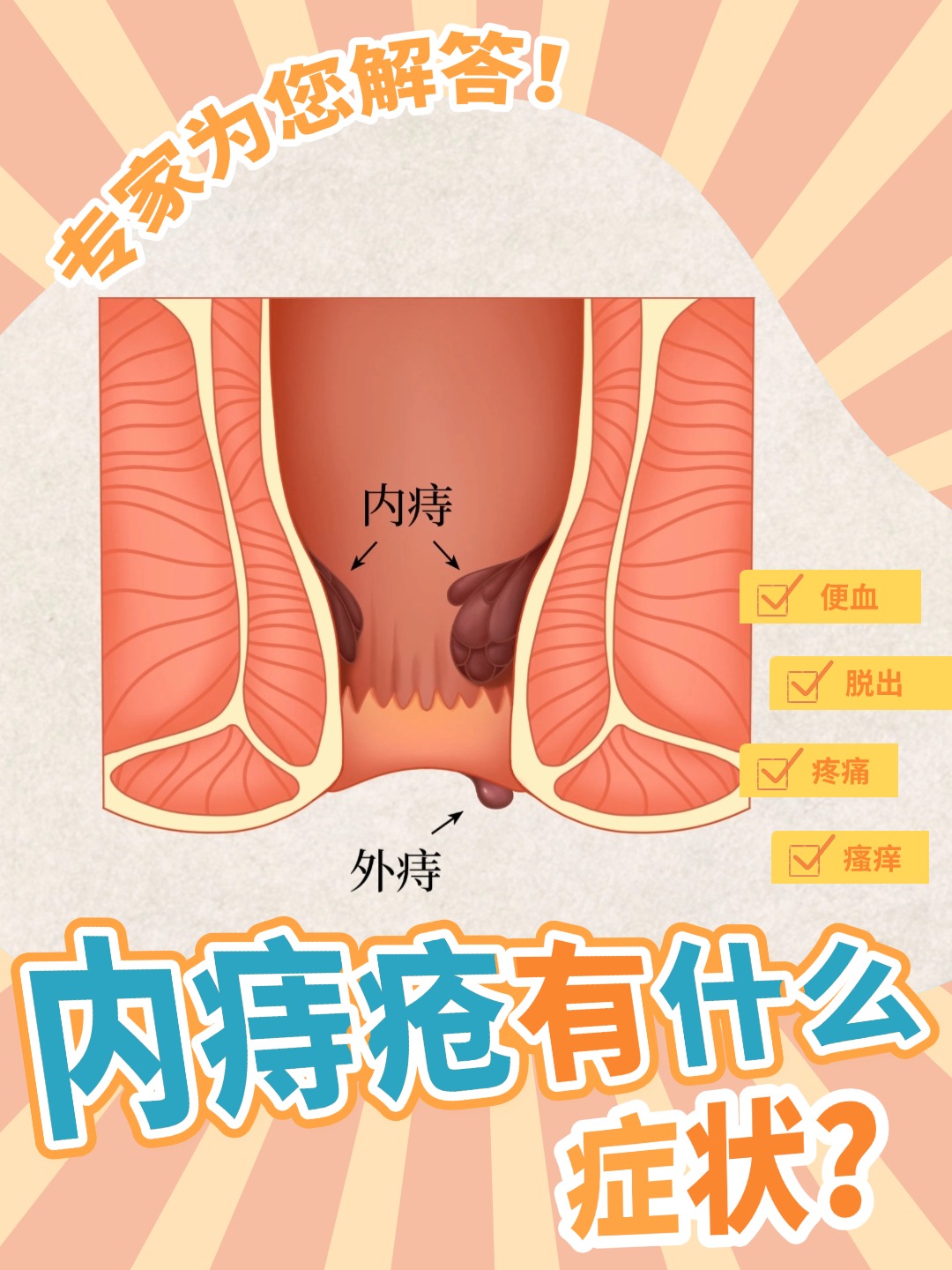 痔疮的初期症状有哪些