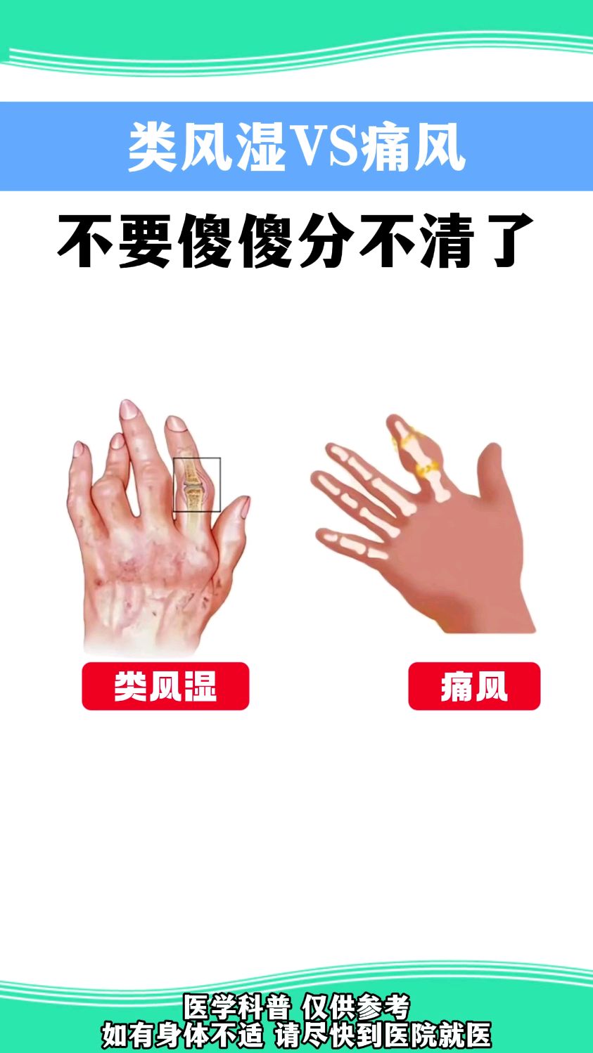 风湿和类风湿的区别有哪些?