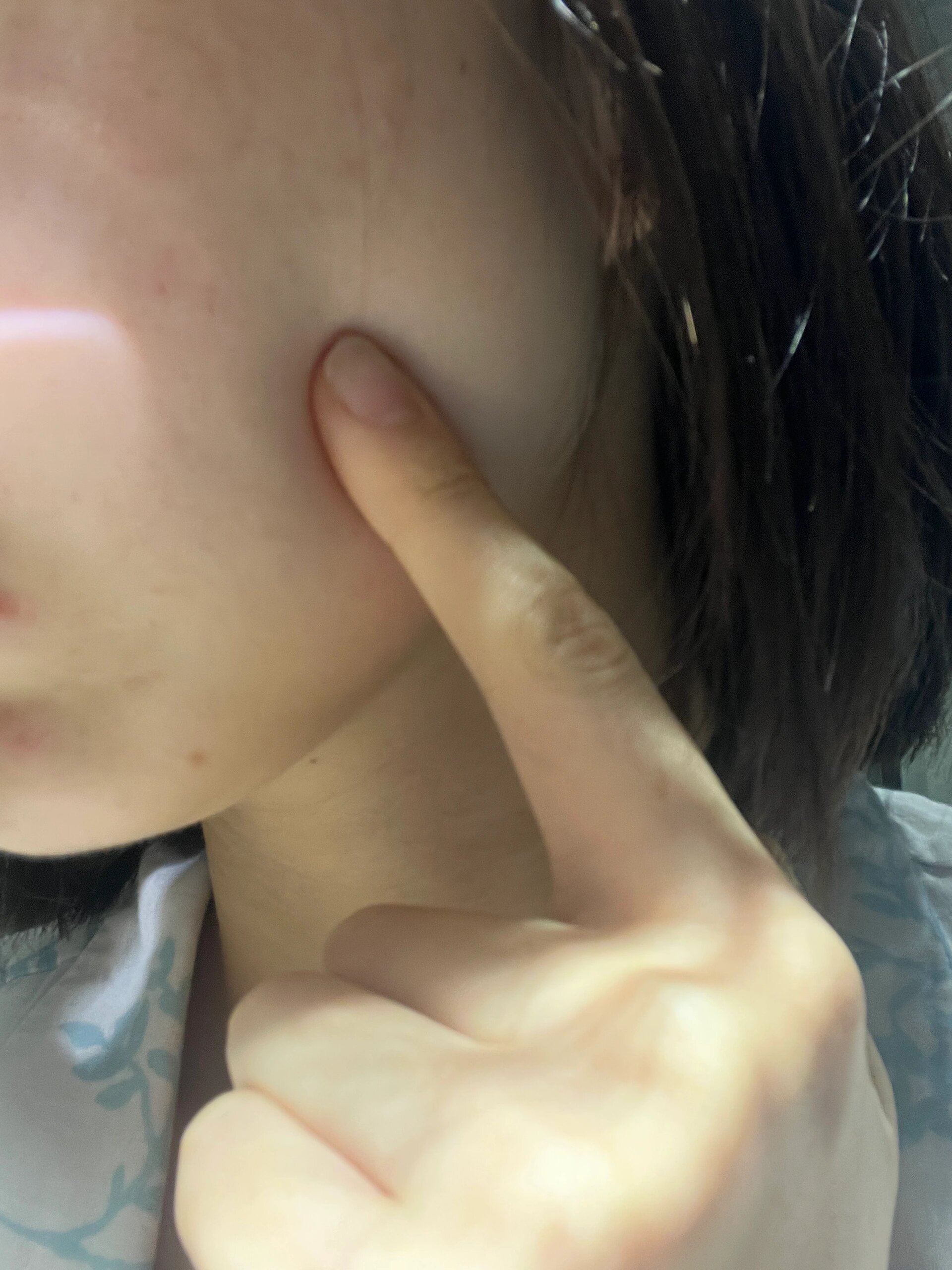 脸部有包凸起不痛不痒什么情况