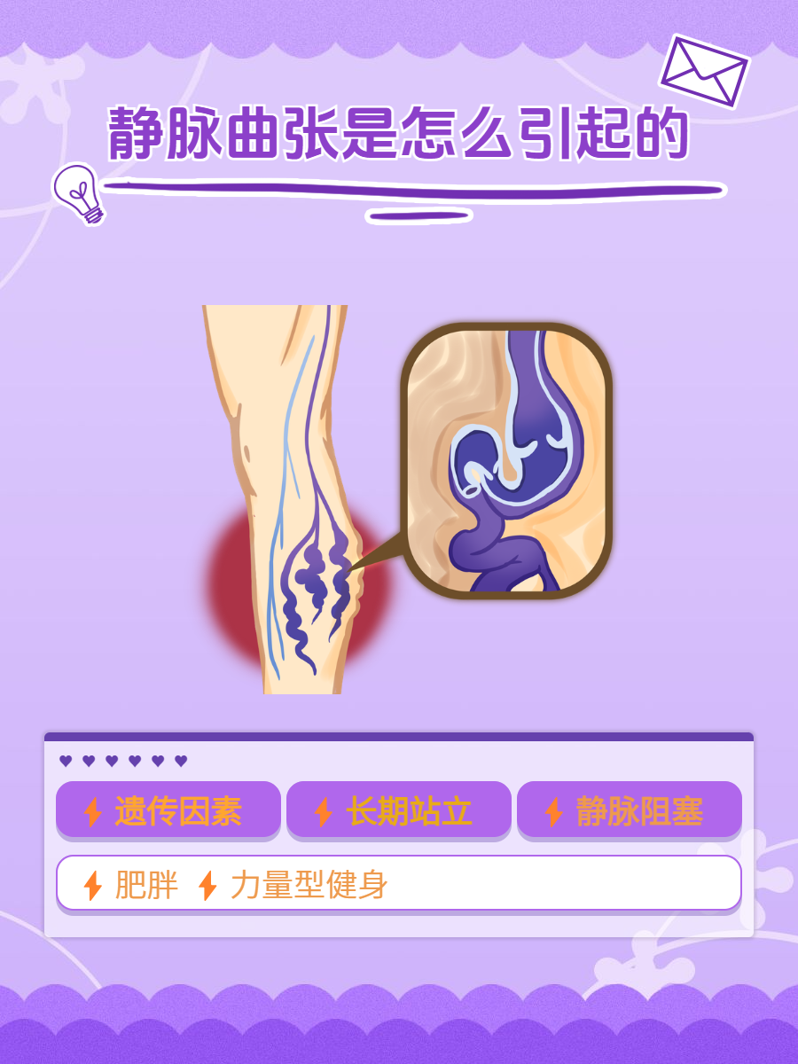 静脉曲张都是什么原因造成的?