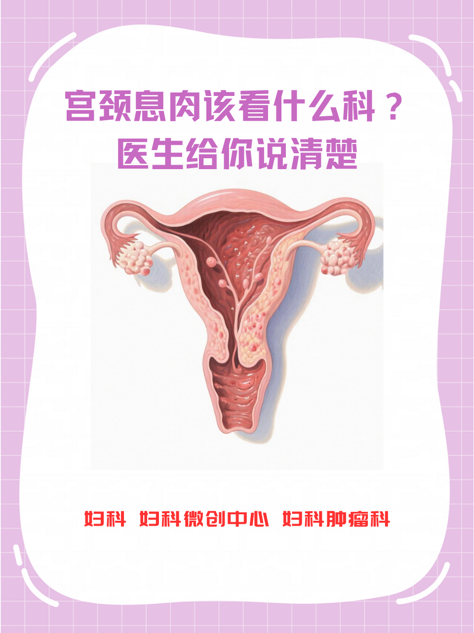 子宫息肉是怎样形成的