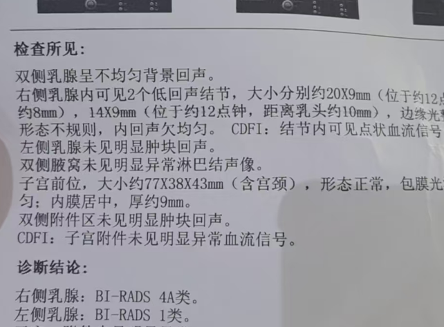 乳腺彩超能检查出什么