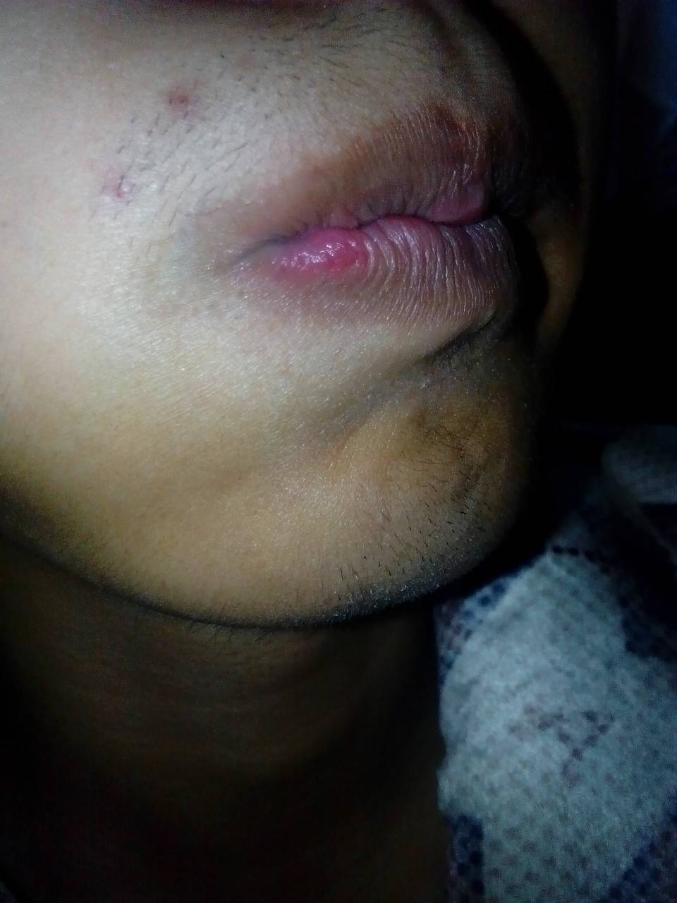 怎么可以让胡子不长