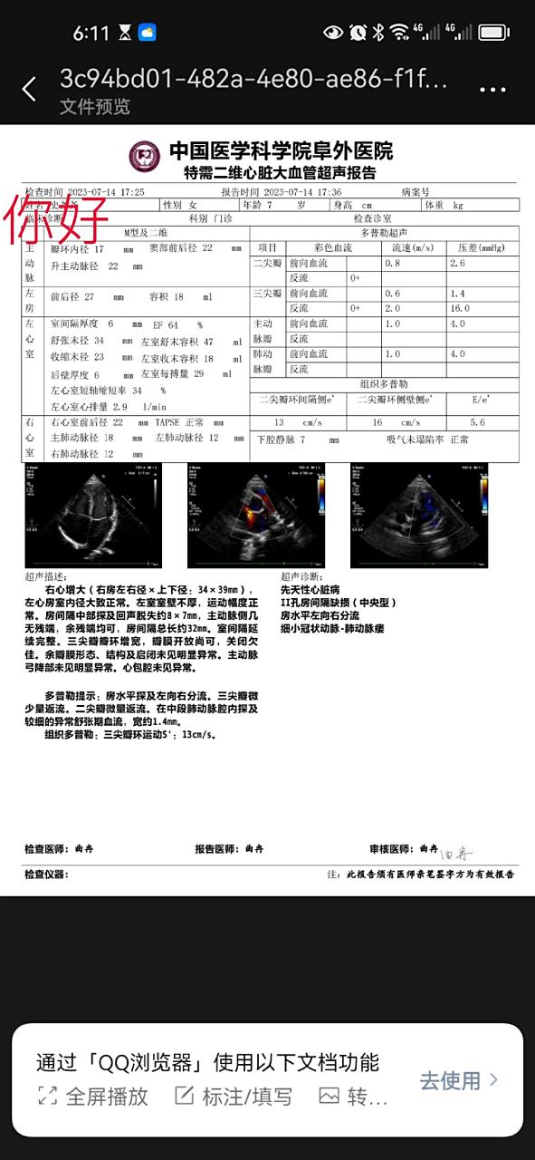 心脏彩超能排除什么病