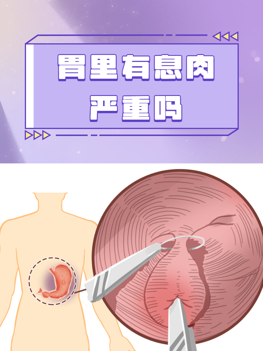 胃息肉一定要做手术吗?