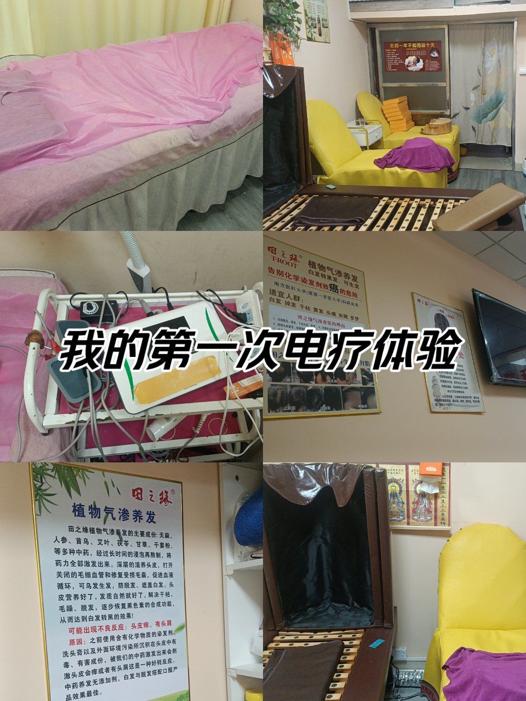 理疗有副作用吗