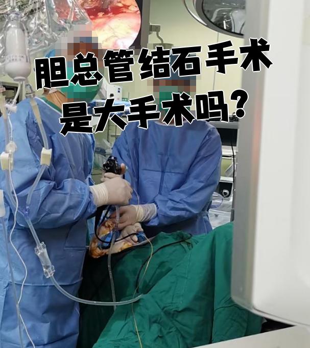胆总管结石必须手术吗?