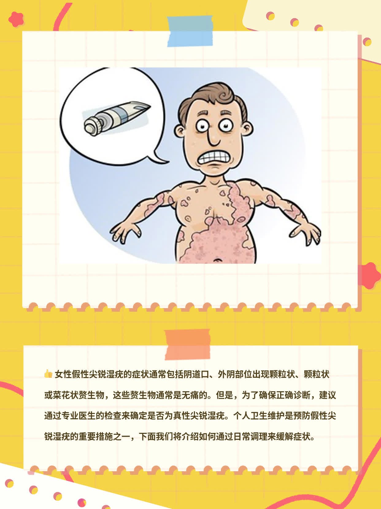 假性尖锐湿疣怎么消除?