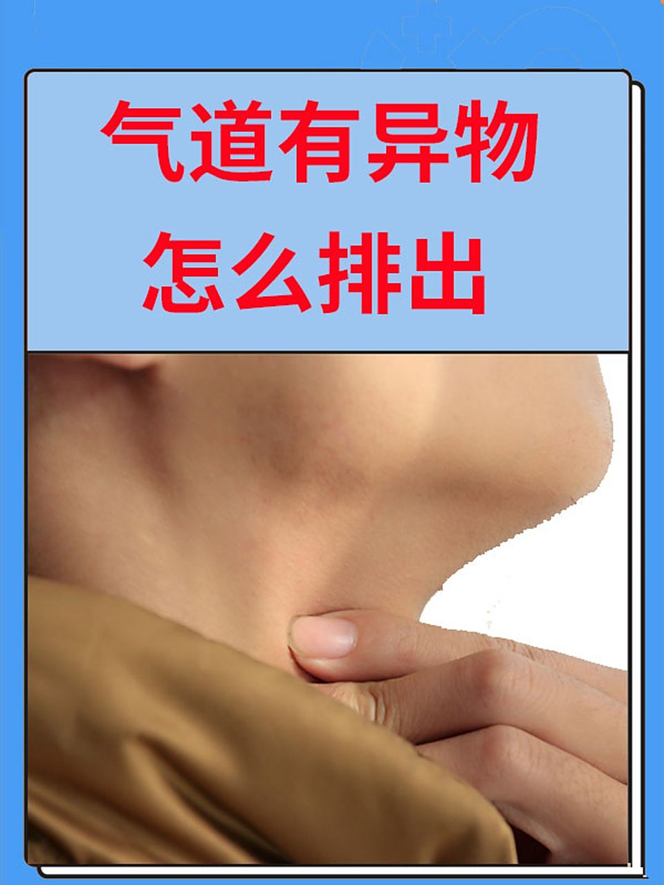 异物进入气管有什么症状