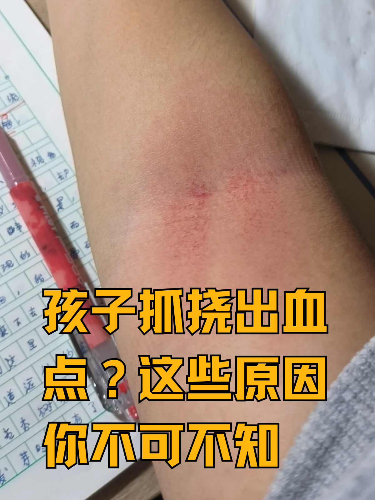 皮下出血是什么原因引起的?