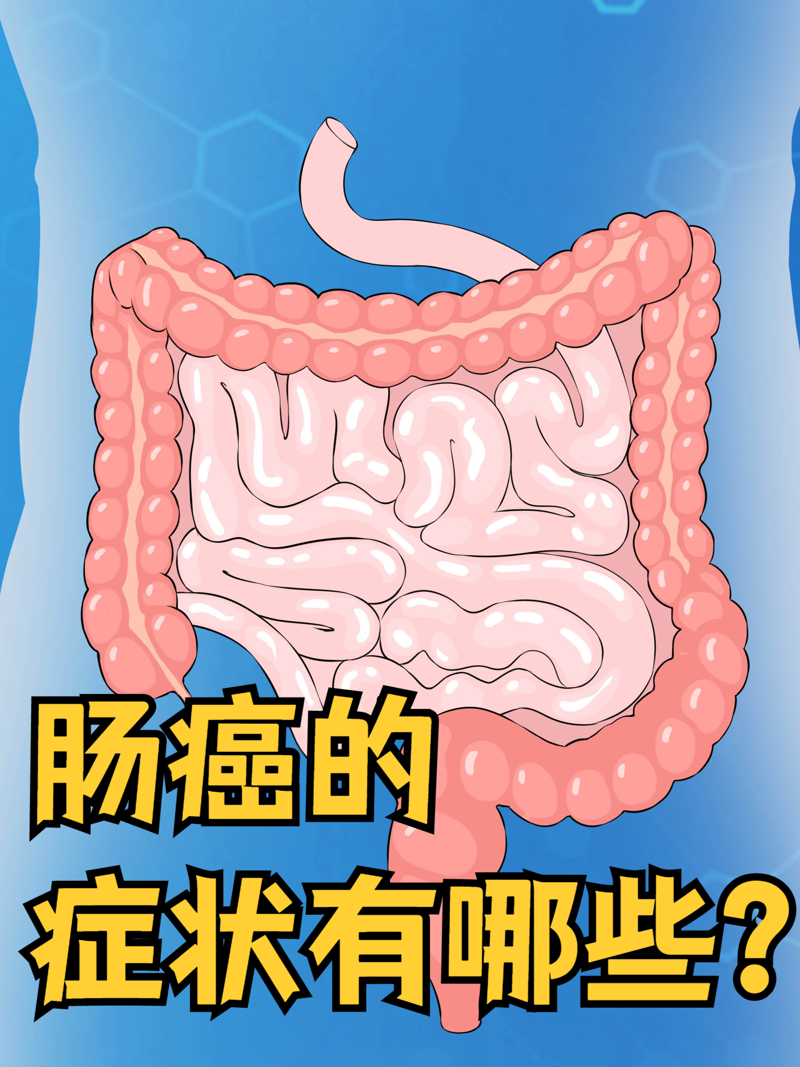 结肠癌大便形状是什么样的?