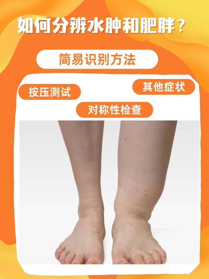 小腿浮肿什么原因