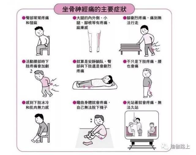 坐骨神经痛的自我锻炼方法