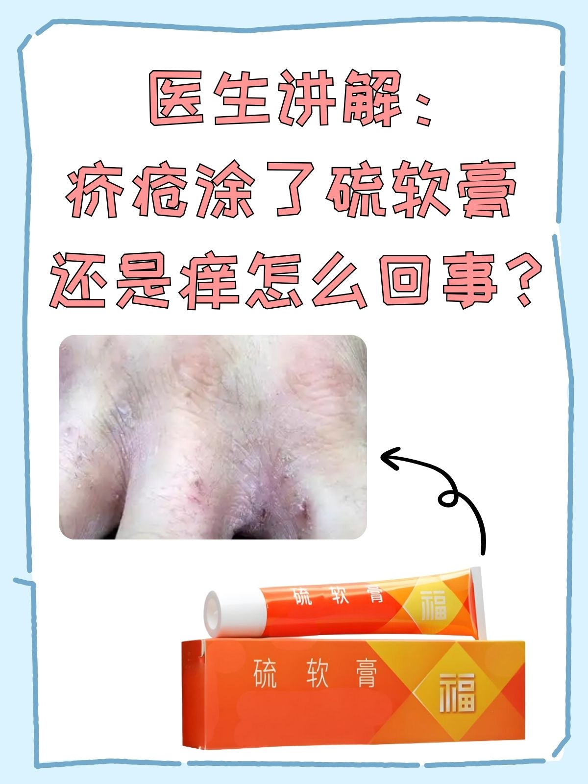 疥疮多长时间能好?、