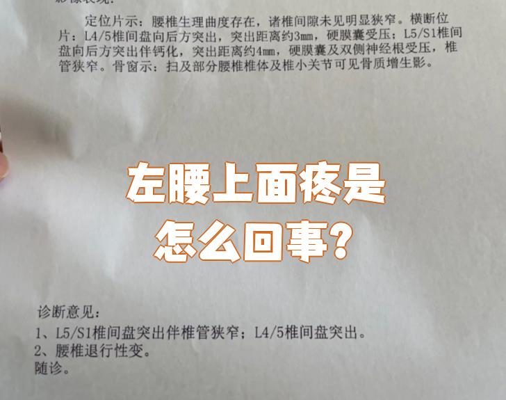 左腰痛是怎么回事?