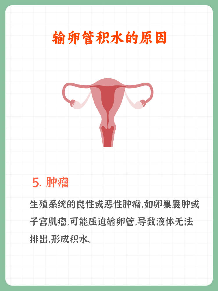 什么原因导致输卵管堵塞