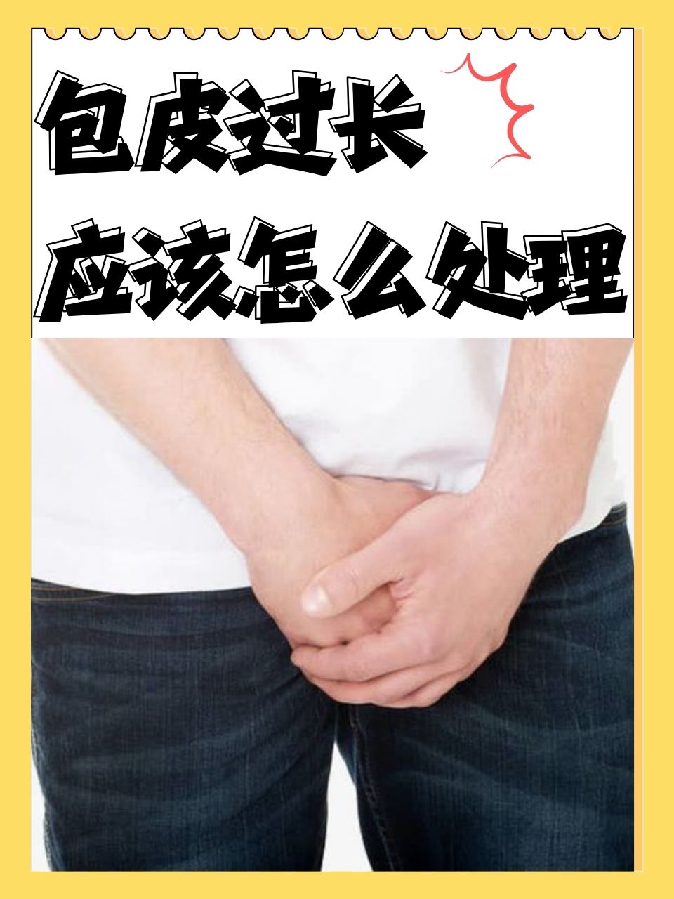 包皮过长不手术会怎么样