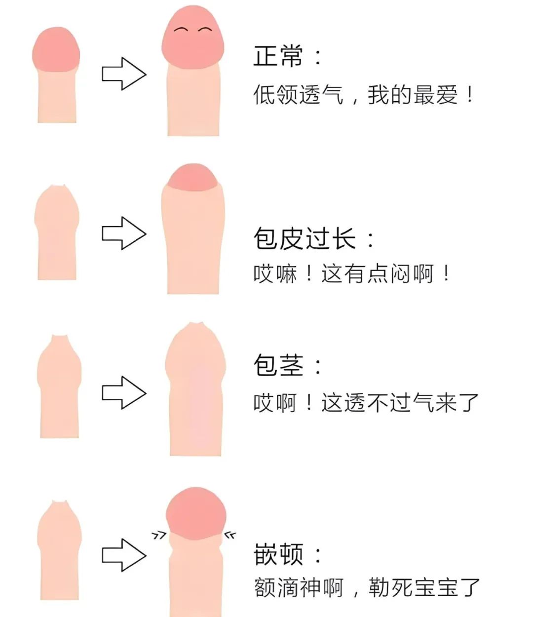 包皮过长不手术会怎么样