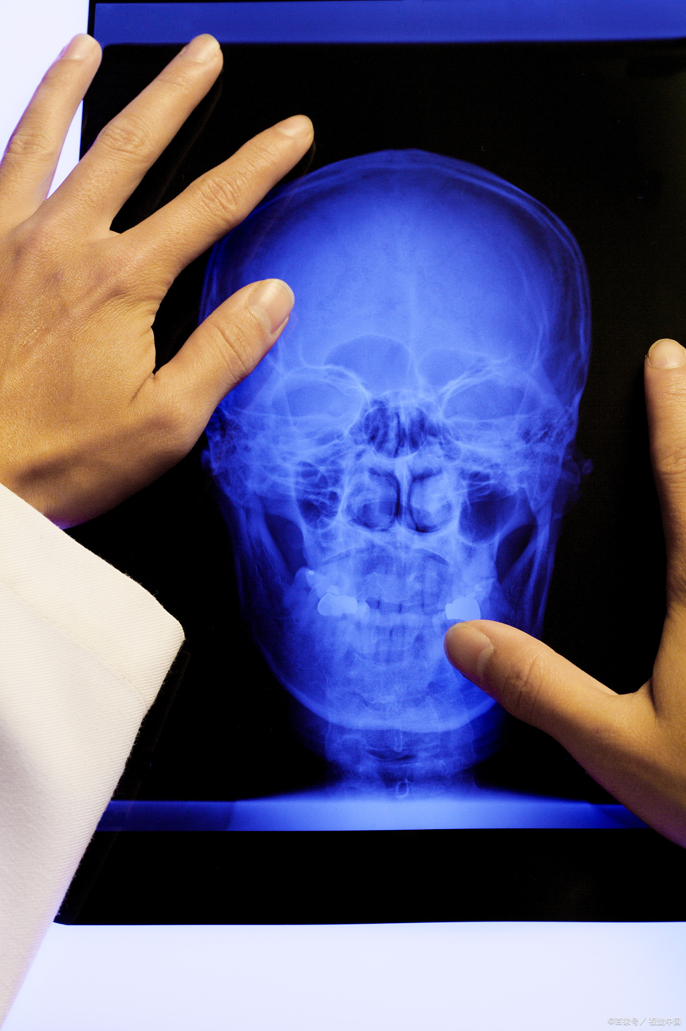 照过X光多久可以怀孕