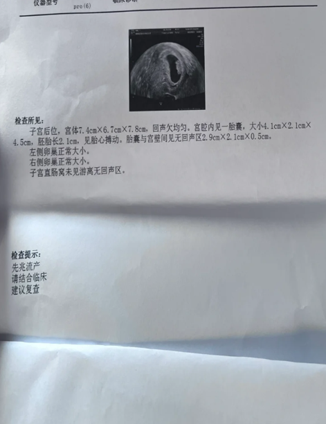 怀孕宫腔积液怎么排出