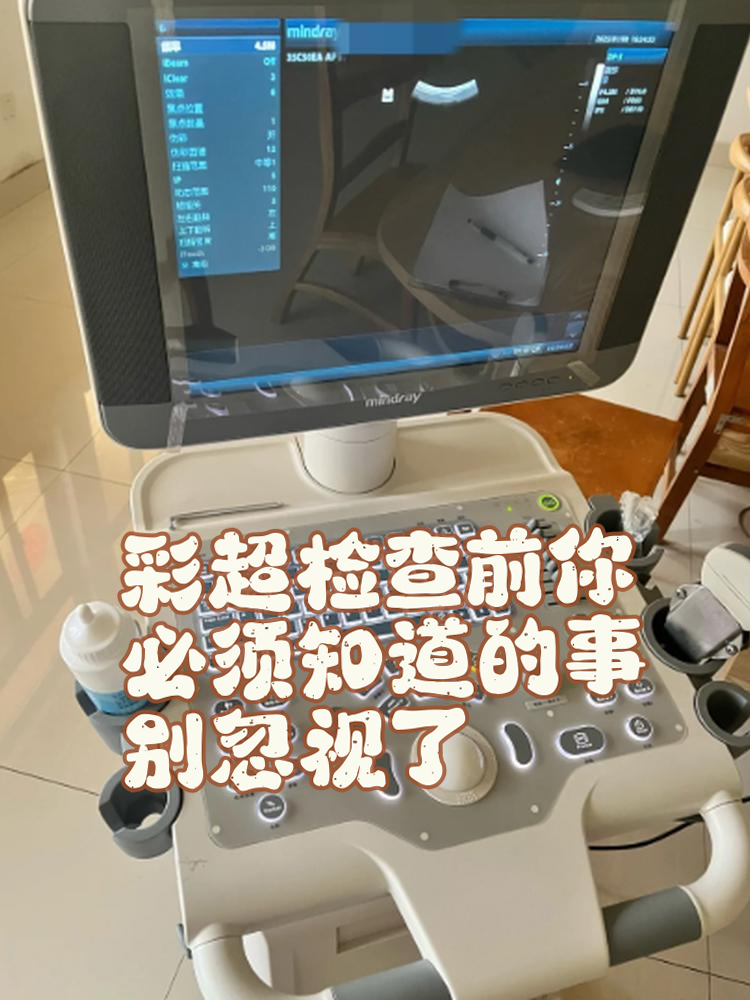 彩超查什么