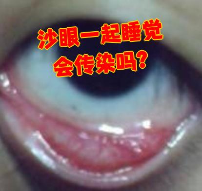 沙眼衣原体是什么意思?