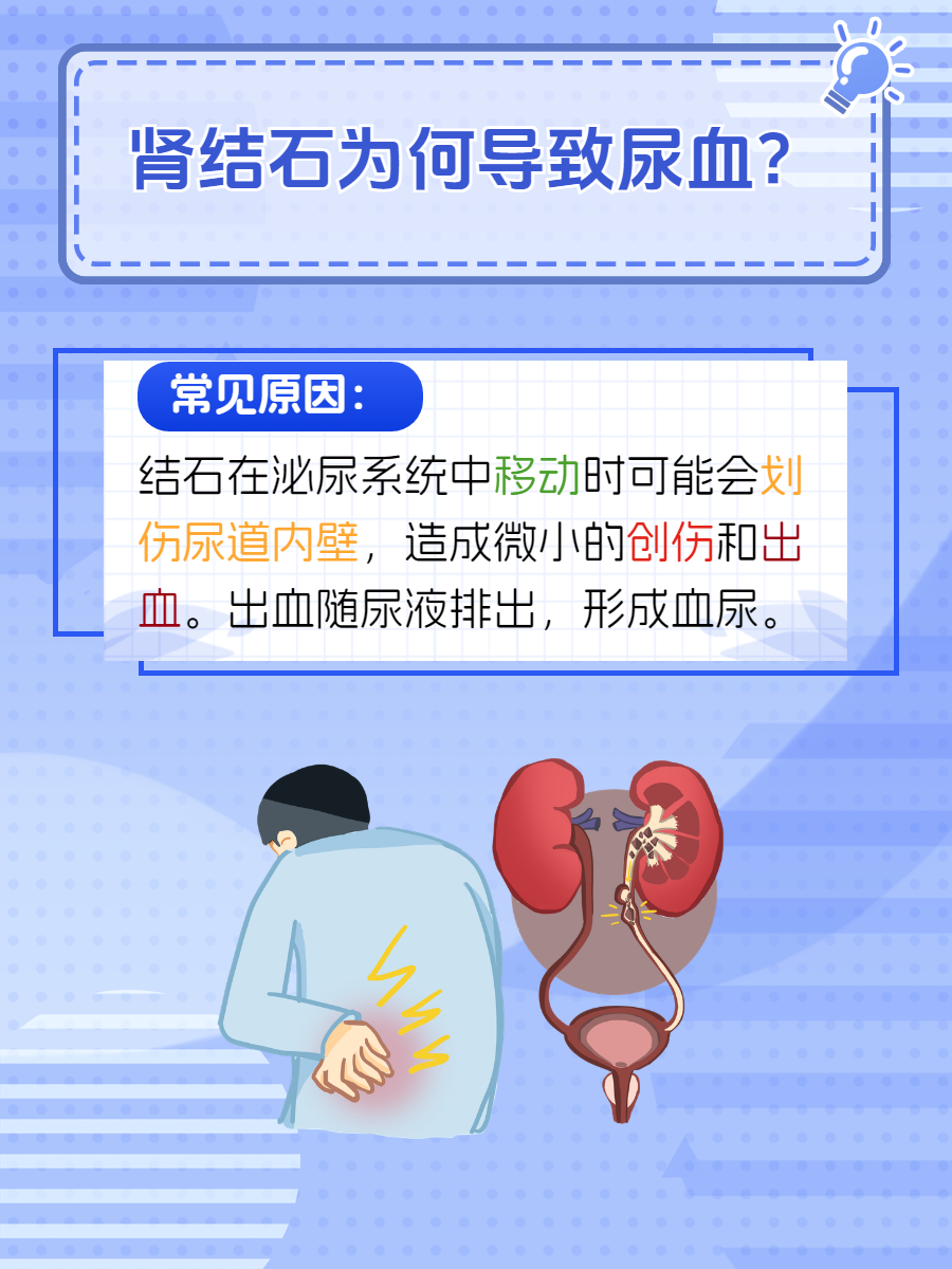 肾结石尿血反复该怎么办