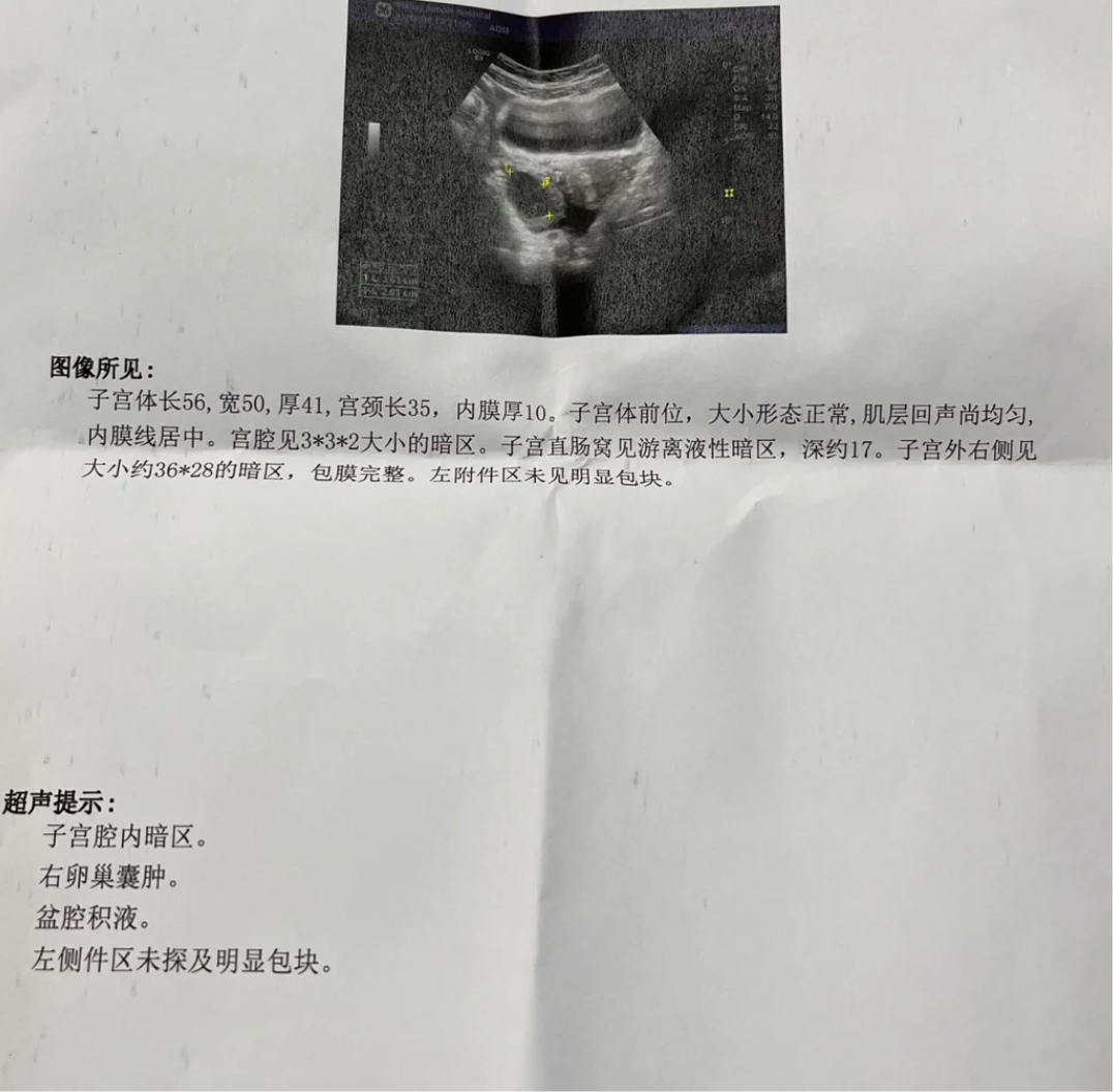 测孕棒一深一浅是怀孕了吗