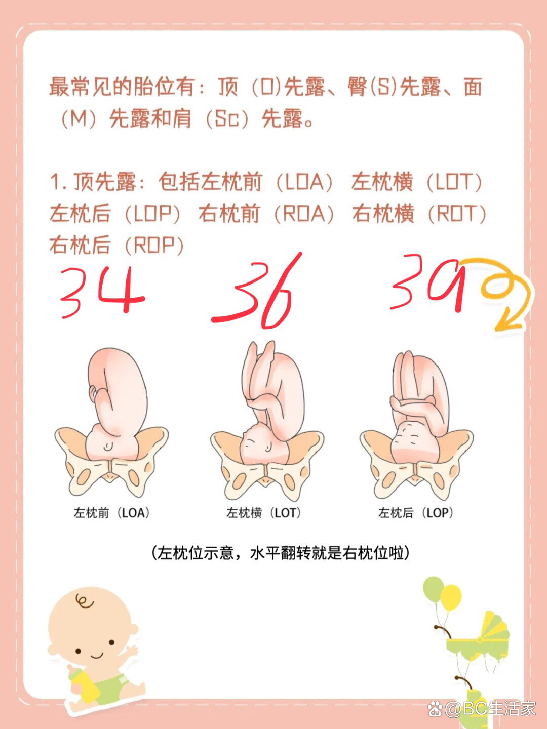 什么是LOA胎位