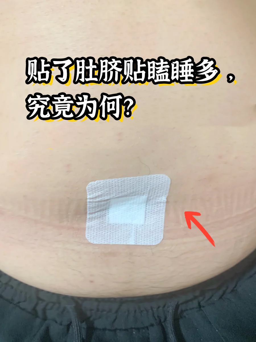 肚脐眼痒是怎么回事