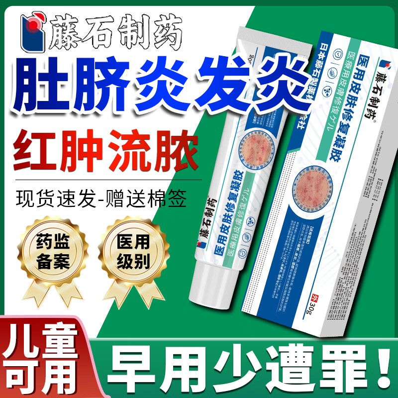 肚脐眼痒是怎么回事