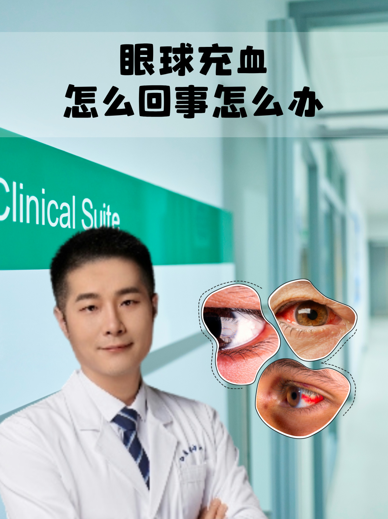 一只眼球疼是怎么回事