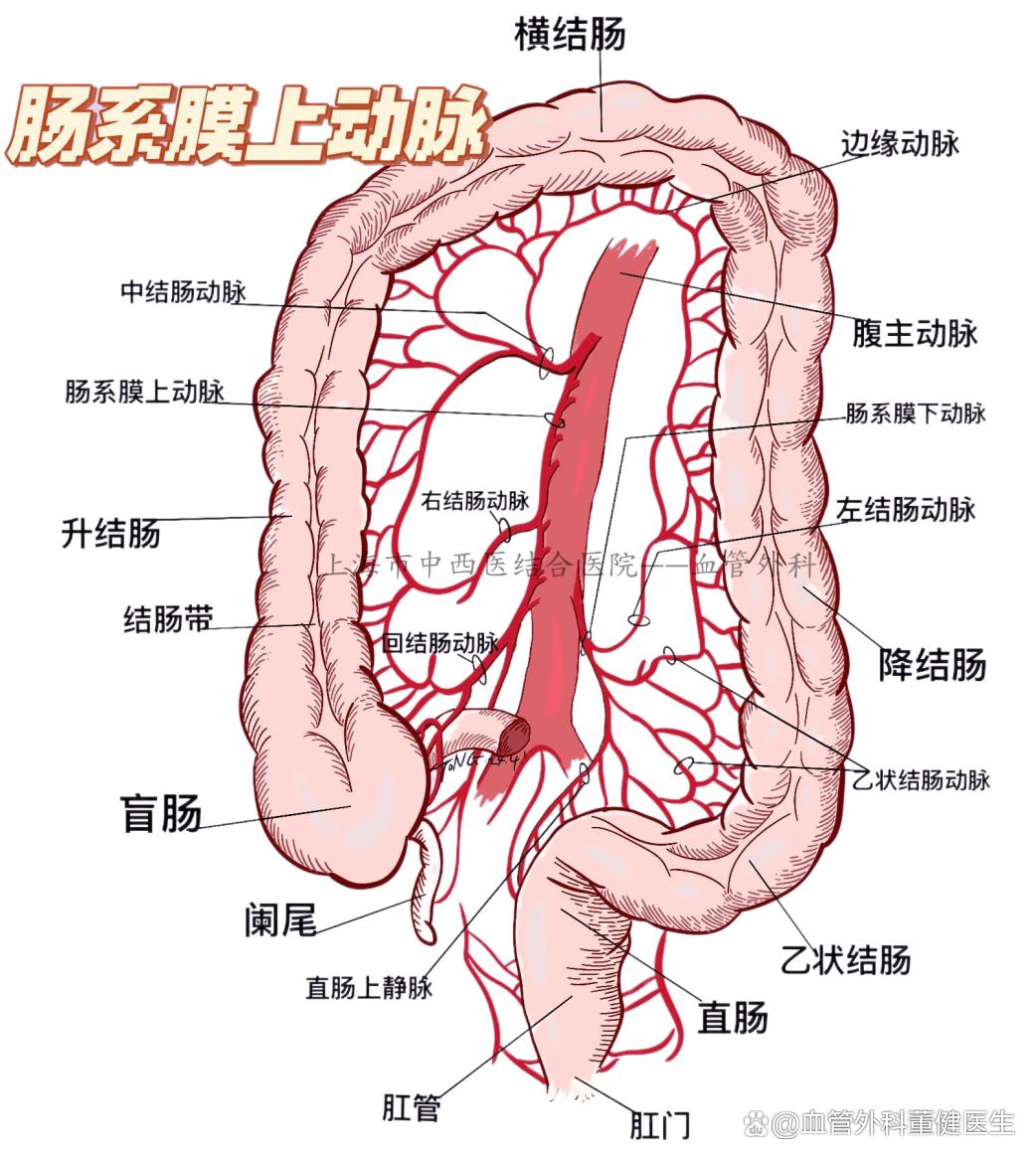 肠系膜上动脉压迫综合症