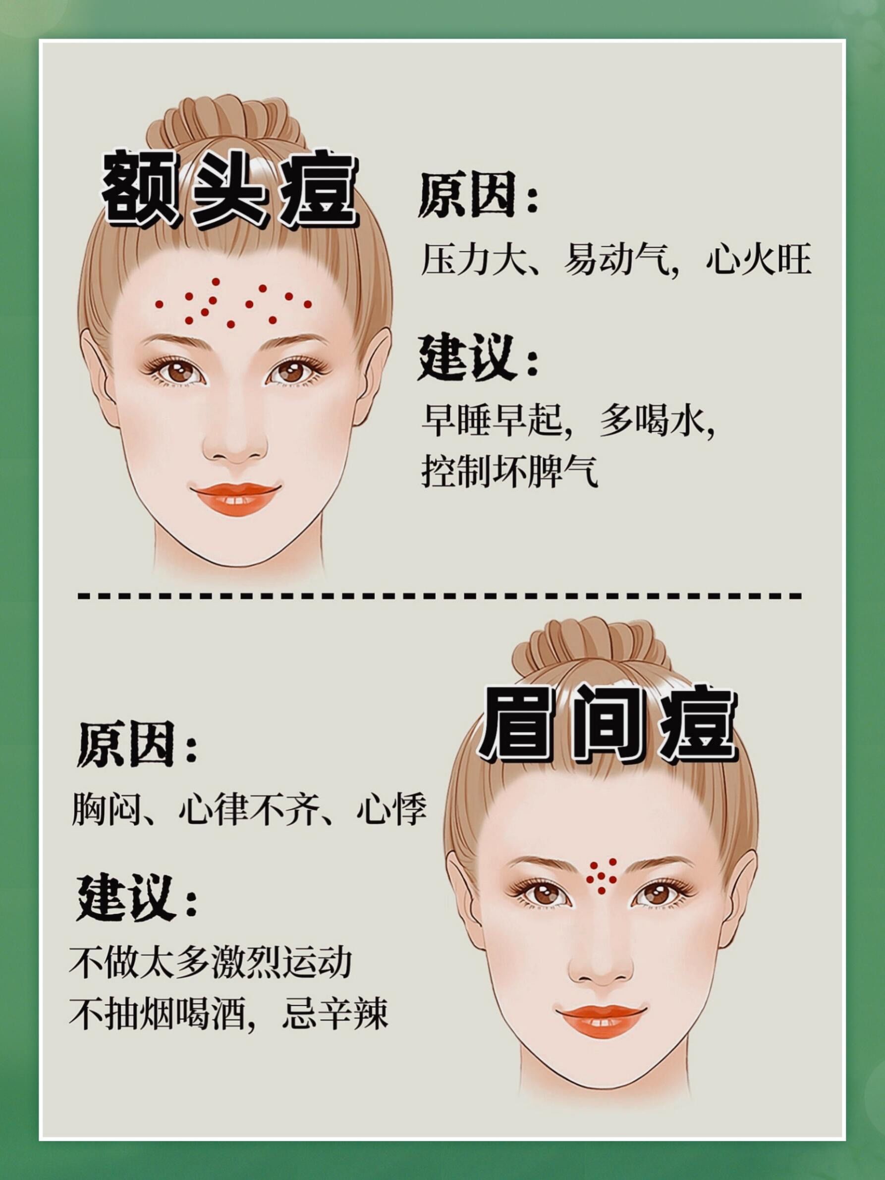 鼻子上长痘痘是什么原因?