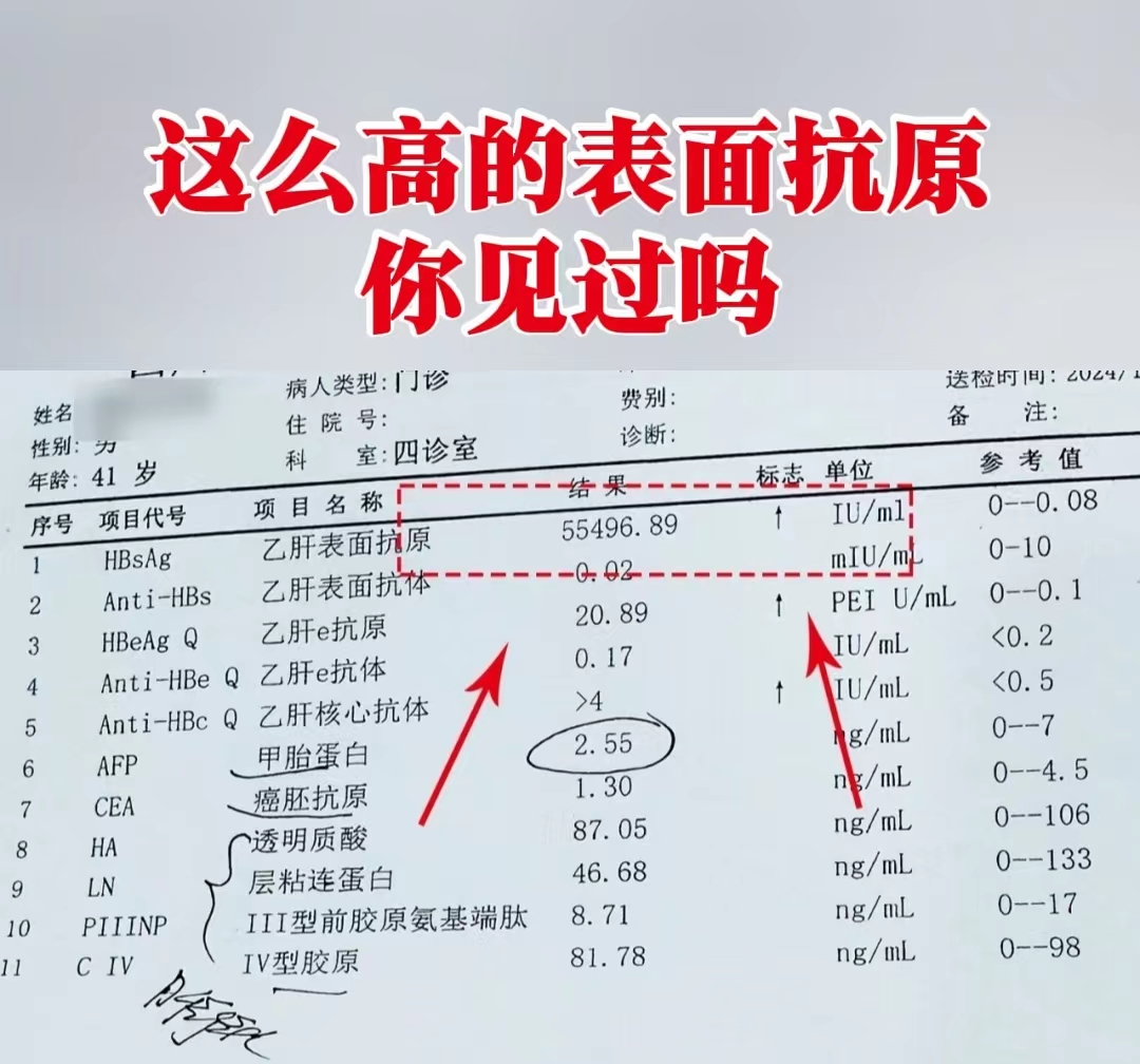 hbsag阴性正常吗?hb