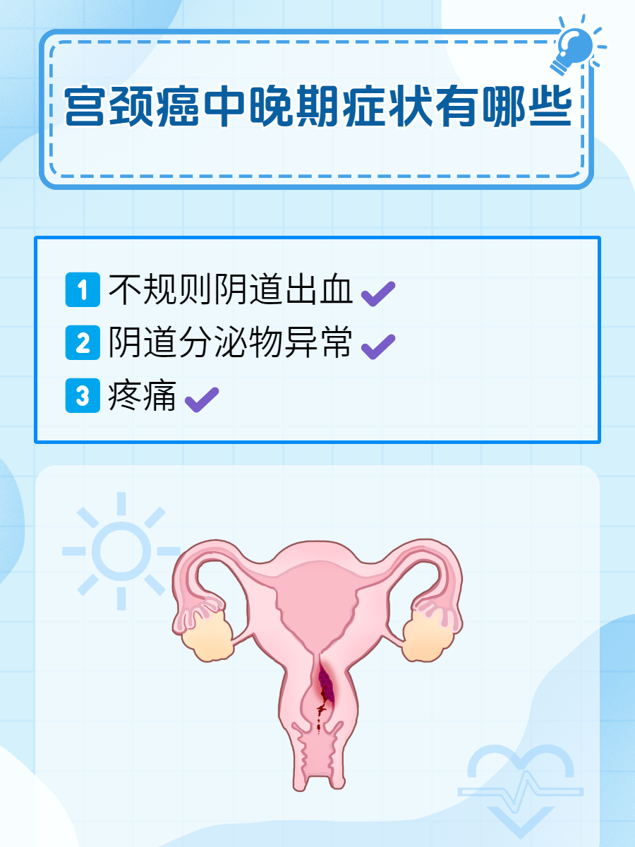 宫颈癌身体有哪些不适