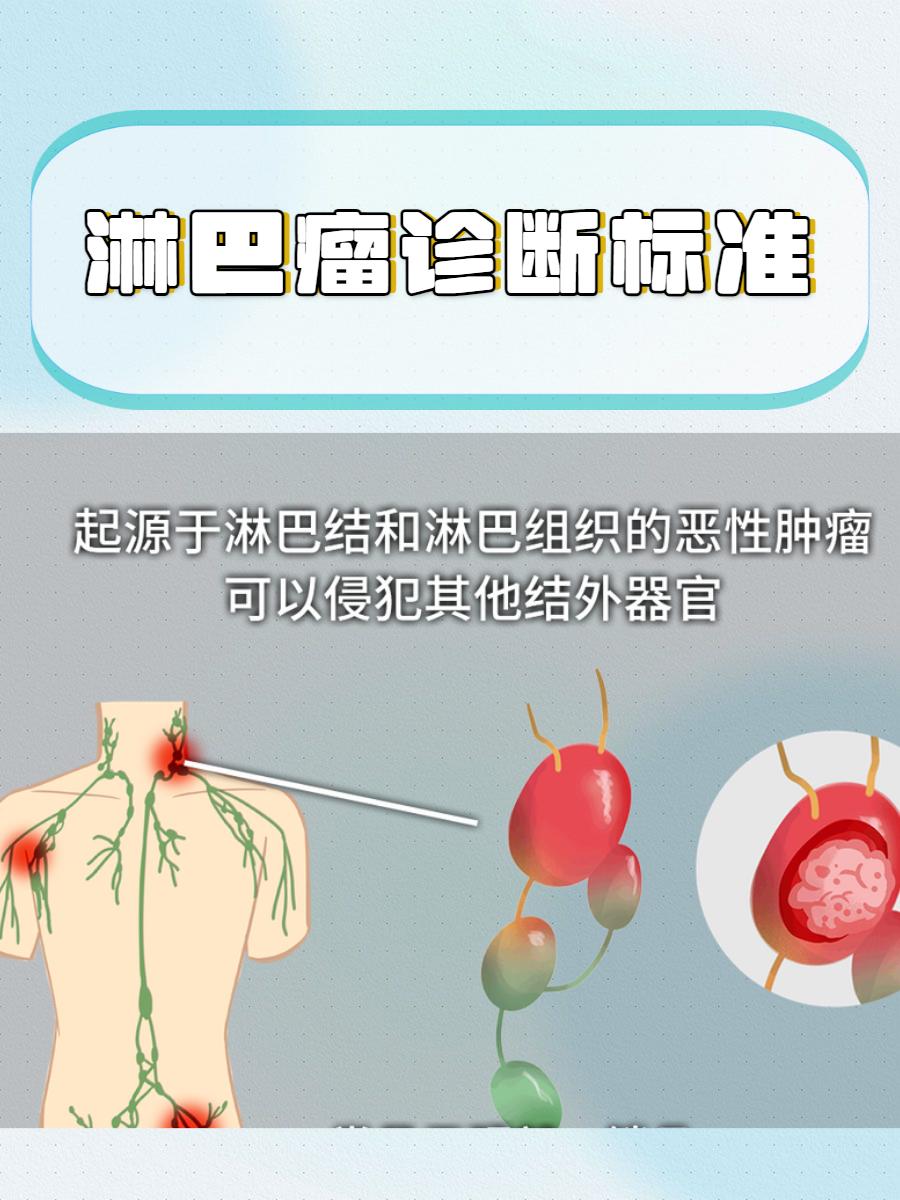 淋巴结转移癌