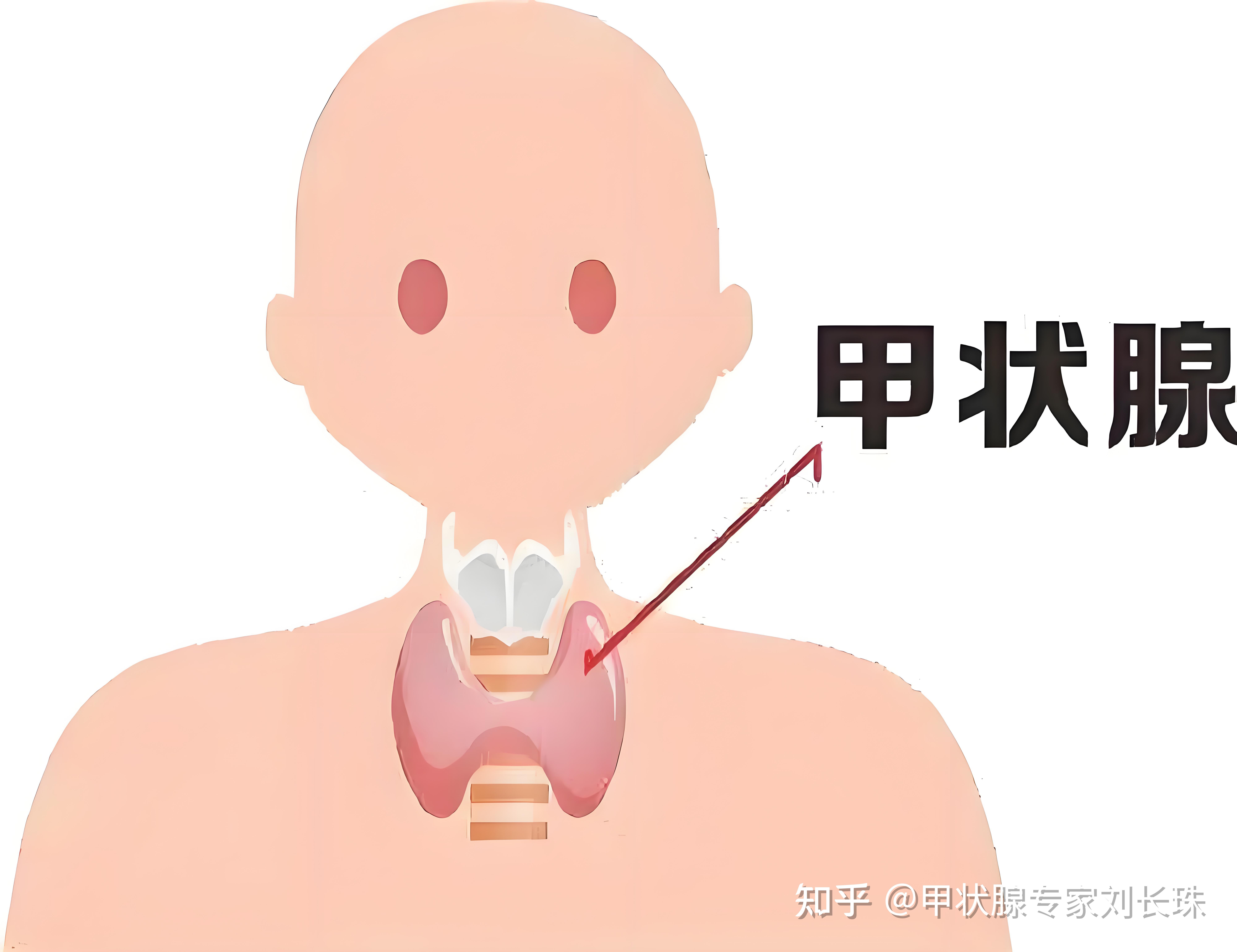 甲亢可以怀孕吗