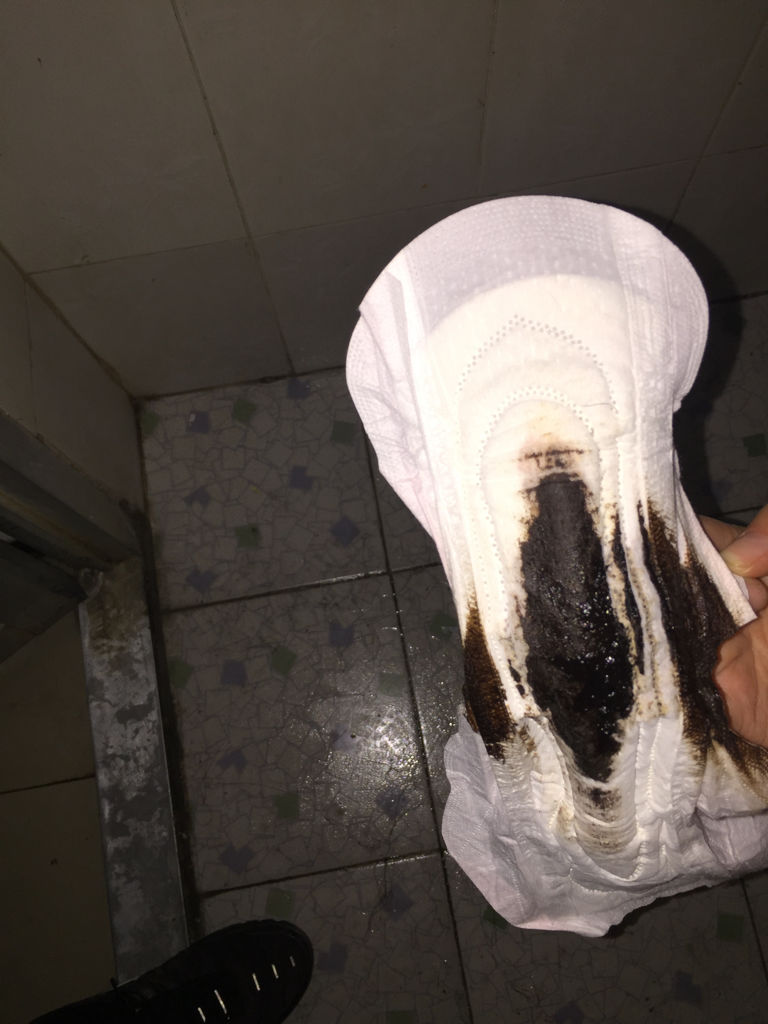 月经颜色应该是什么样子
